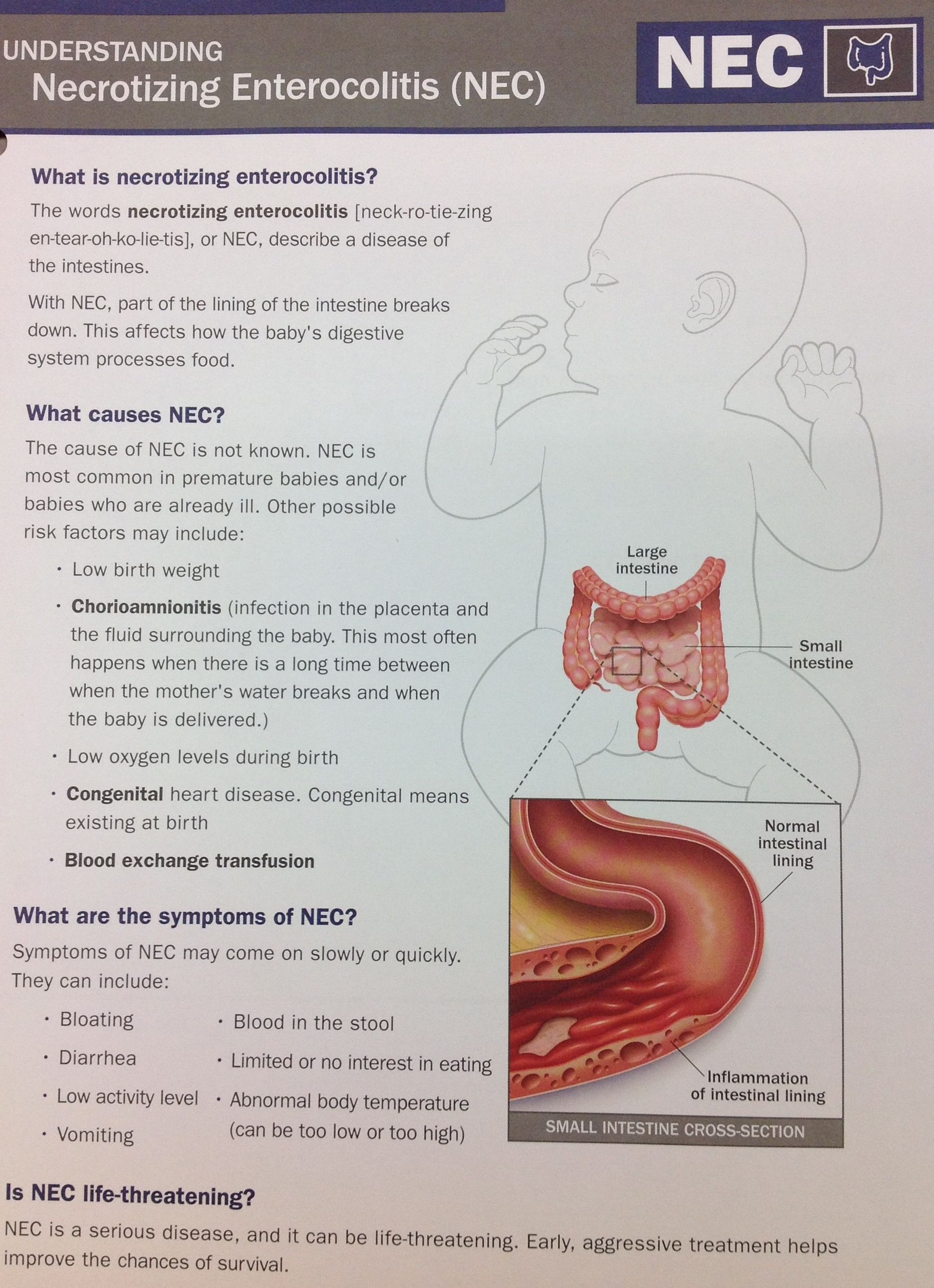 Understanding Necrotizing Entercolitis (NEC) #NEC
