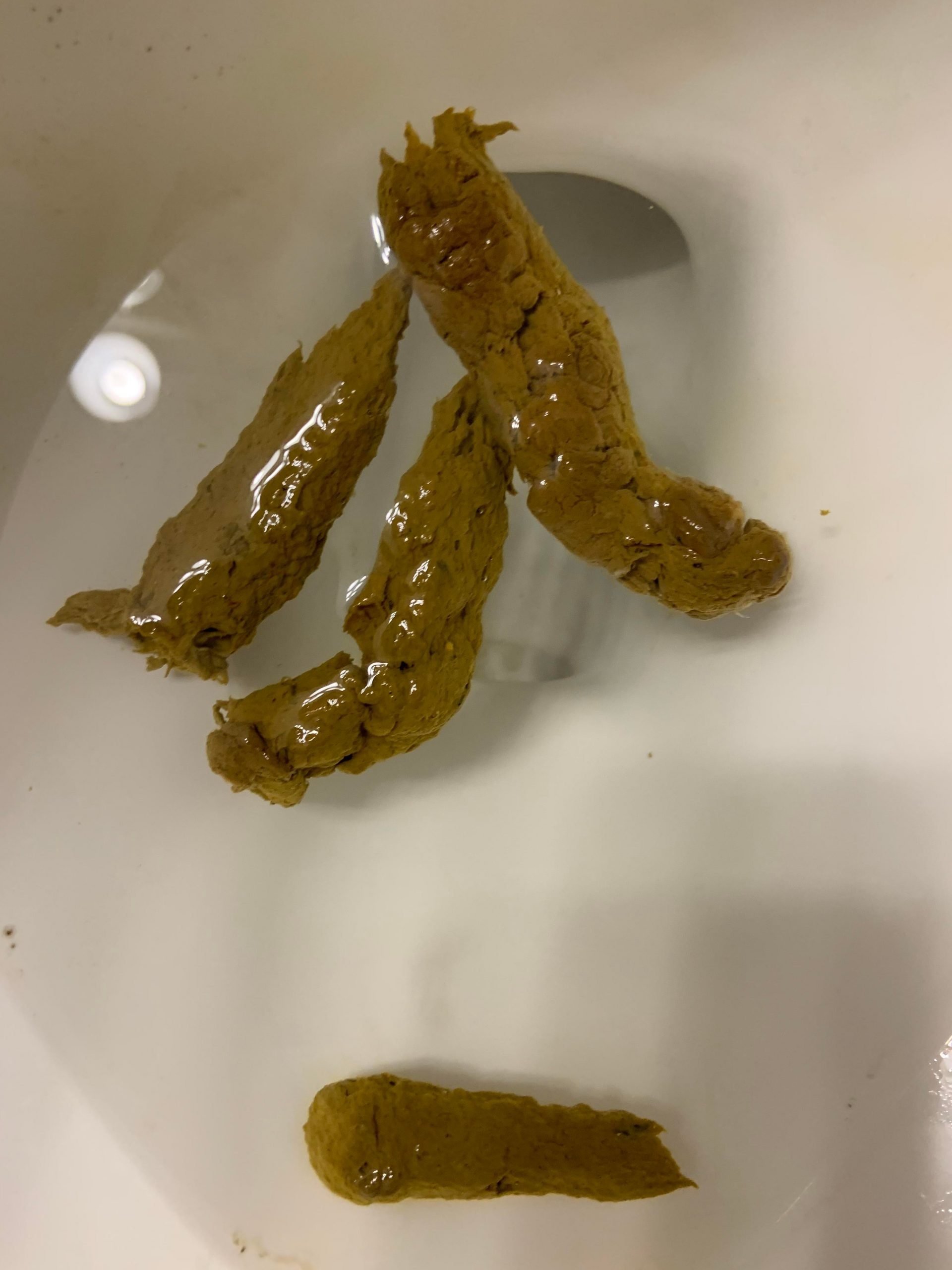 Warning Poop: does this look like fatty stool? Normal diet and fecal ...