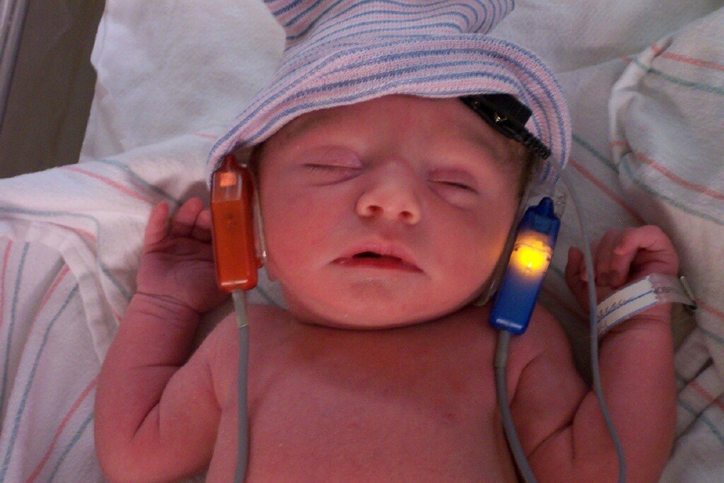 What Can A Newborn Hearing Test Tell you? Speech Buddies