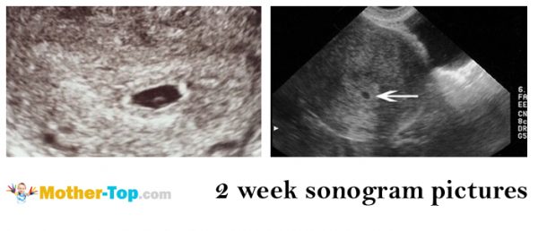 What happens in the second week of pregnancy?