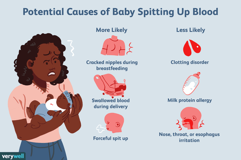 Why Is My Baby Throwing Up After Breastfeeding